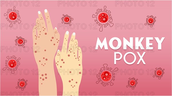 Monkeypox virus Illustration