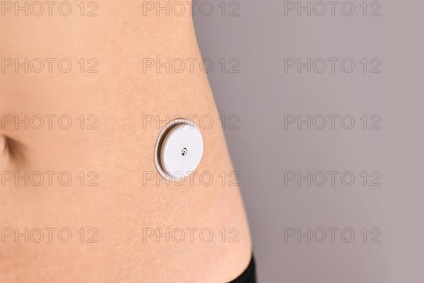 Sensor system for glucose monitoring attached to skin of person with diabetes illness used to permanently keep track of blood sugar level