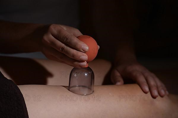 Cupping