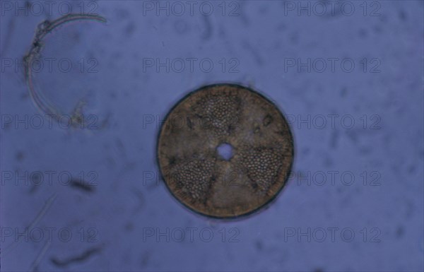 Acrinoptychus senarius living in plankton x130 magnification