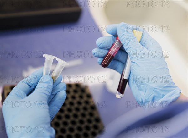Close up doctor holding tube with blood