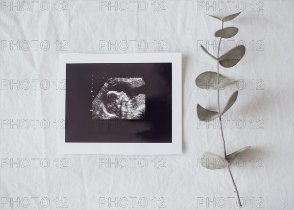 Top view x ray photo fetus. Resolution and high quality beautiful photo