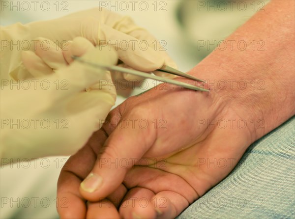 This internist in the centre of a larger city works mainly as a family doctor. The photo shows: Treatment of a person injured in an industrial accident. . Stitch removal