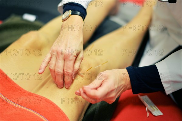 In the family doctor's consultation. Acupuncture