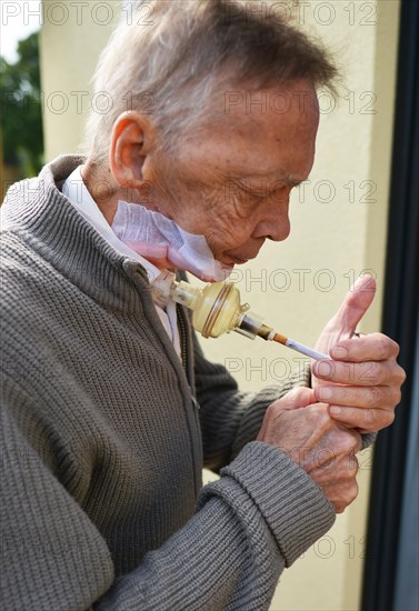 The Mother Theresa Hospice offers its guests a dignified home in a new friendly ambience for patients in their last phase of life. This patient with carcinoma of the floor of the mouth caused by smoking and alcohol is 'allowed' to continue smoking