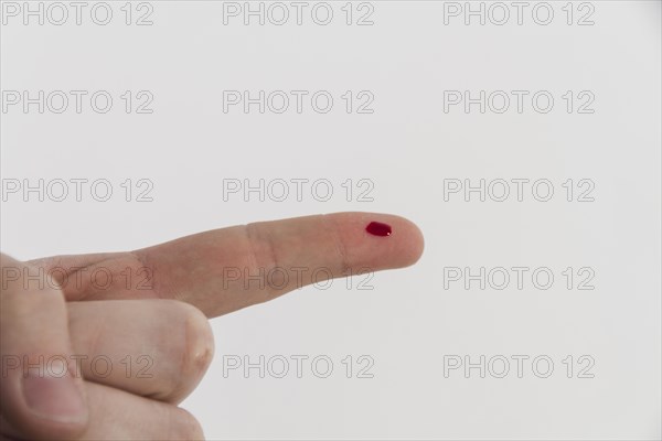 Bleeding finger