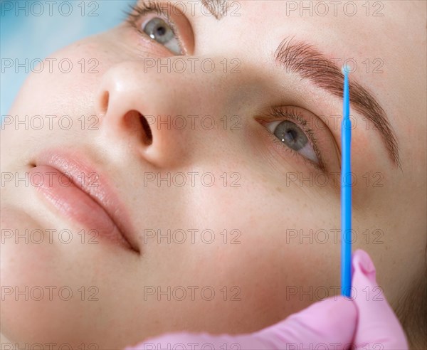 Permanent microblasting tattooing freckles to a woman in a beauty salon