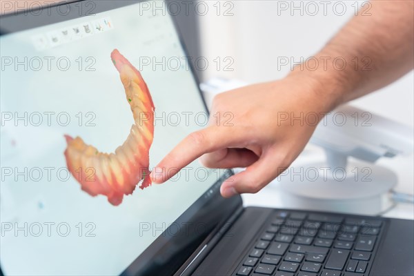 A doctor in the dental clinic explaining and looking at the 3d of the x-ray on the computer