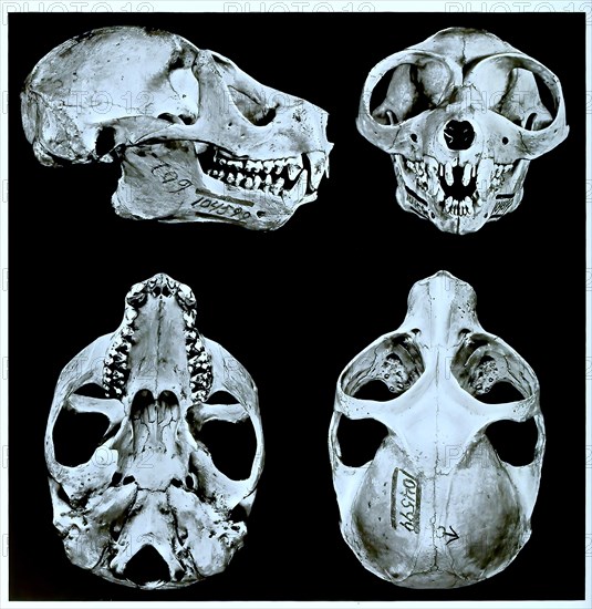 Skull bone