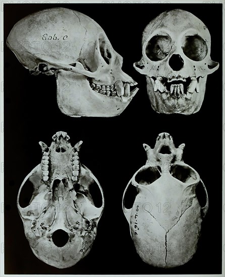 Skull Bone