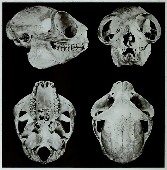 Skull bone