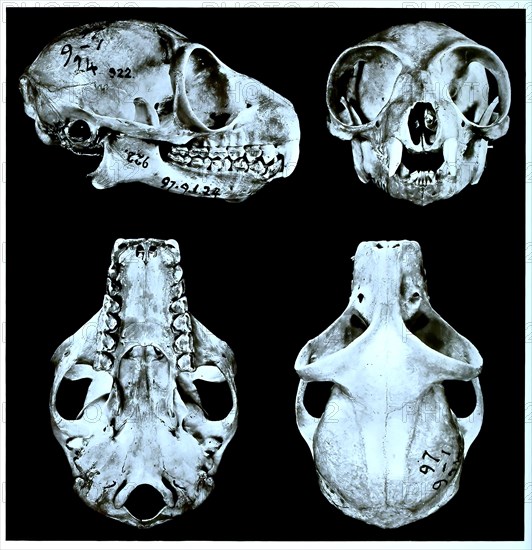 Skull bone