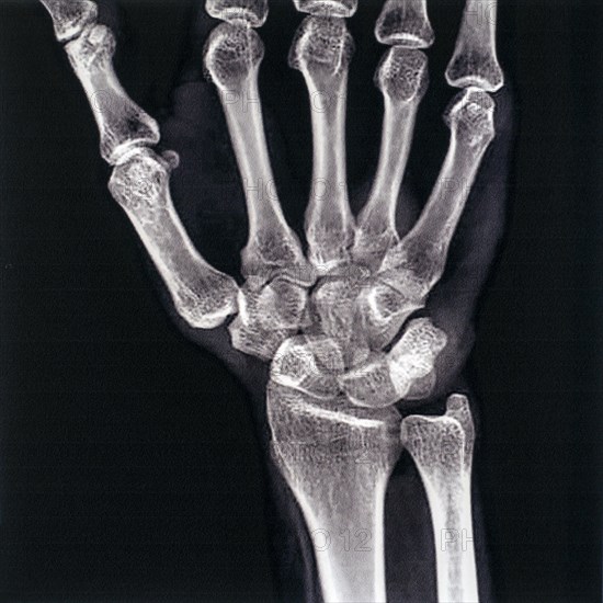 Mid 20th century X-ray photograph