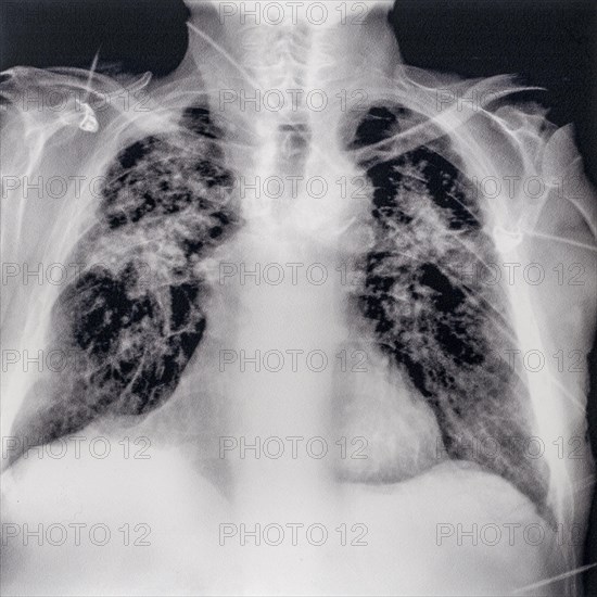 Old mid 20th century X-ray photograph