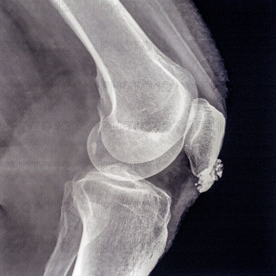 Mid 20th century X-ray photograph