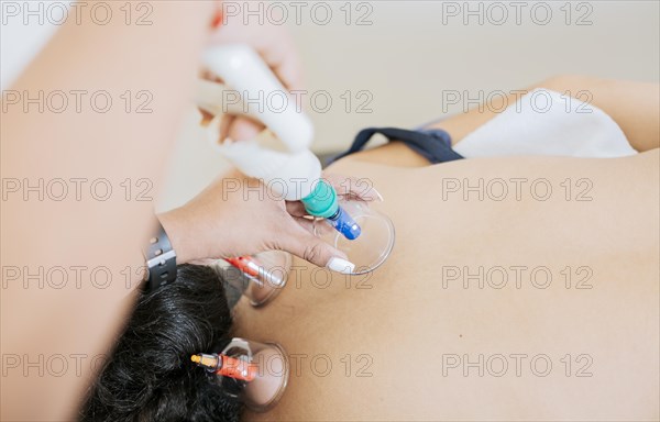 Modern physiotherapy with cupping