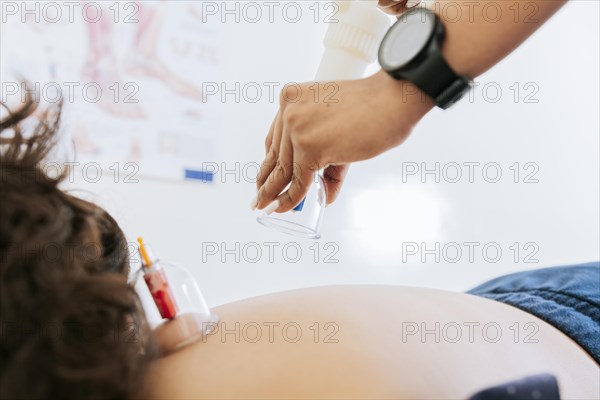 Physiotherapist placing cupping on patient