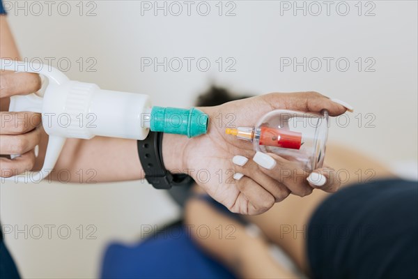 Close up of professional performing cupping treatment on patient