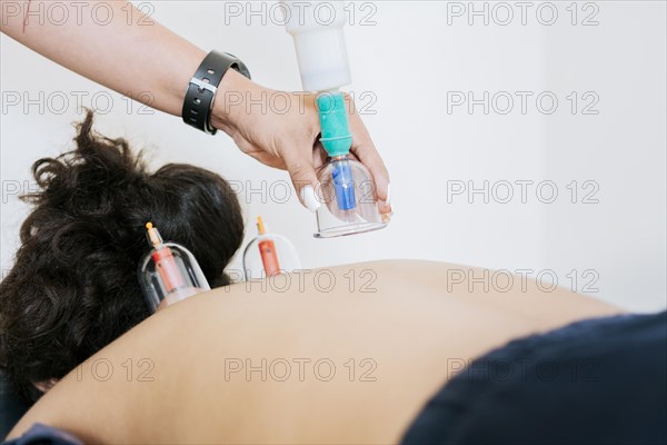 Physiotherapist placing cupping on lying patient