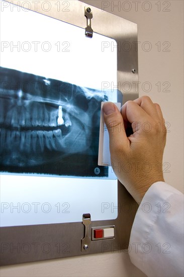 Doctor checking panoramic x-ray in his office