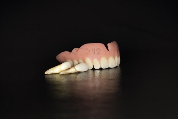 Denture upper jaw made of plastic with pulled teeth