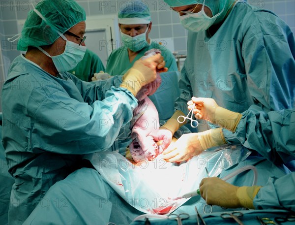 A caesarean section