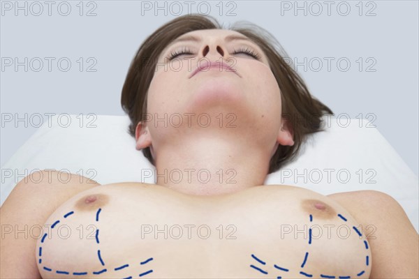 Breast surgery in preparation