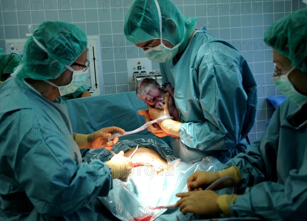 A caesarean section