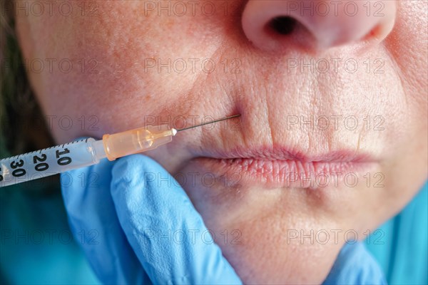 Older woman injected in lips Hyaluronic acid, Woman in beauty salon. plastic surgery clinic