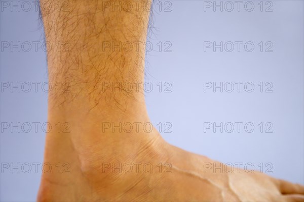 Adult males right ankle