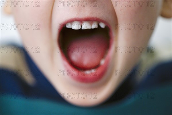 Symbol photo. A boy screams while showing his open mouth. Berlin