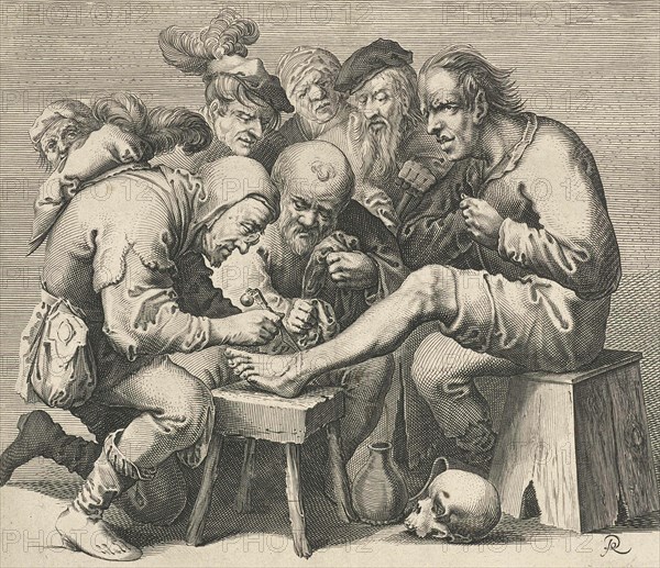 Operation on the foot for teaching purposes by a doctor in the Middle Ages many students are present