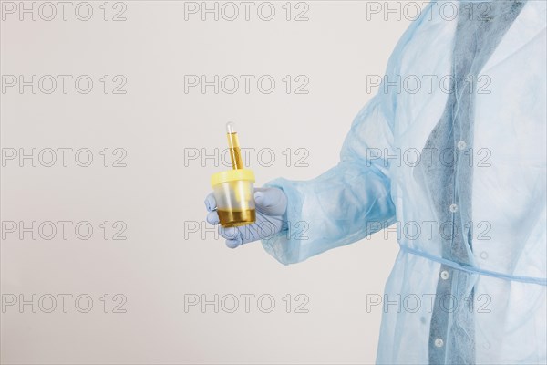 Surgeon s hand holding urine test