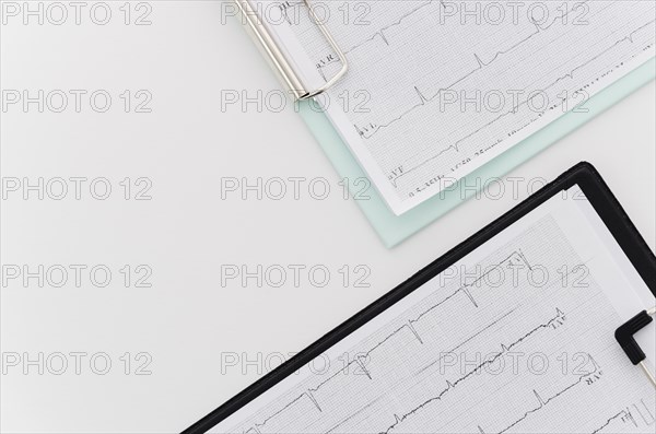 Overhead view ecg medical report blue black clipboard white background