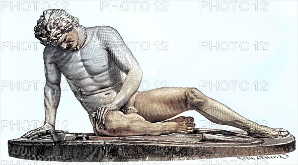 A Dying Gaul