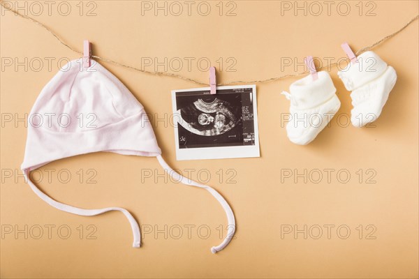 Baby s cap ultrasound picture pair woolen shoes hanging clothesline against orange backdrop