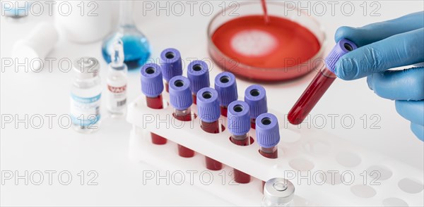 Coronavirus vaccine lab with samples