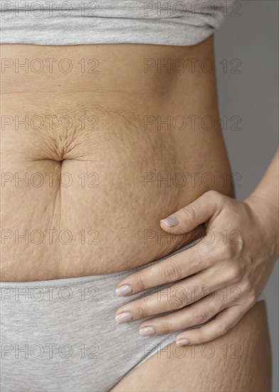 Close up body with stretch marks