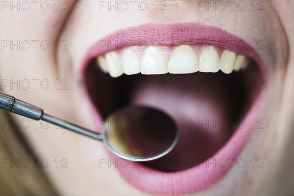 Open mouth woman with dentist mirror