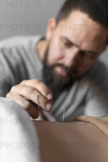 Close up therapist holding acupuncture needle
