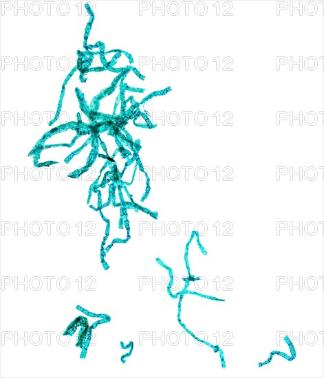 Spirogyra plant micrograph