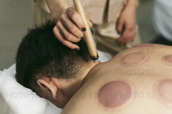 Suction cups therapy session close up
