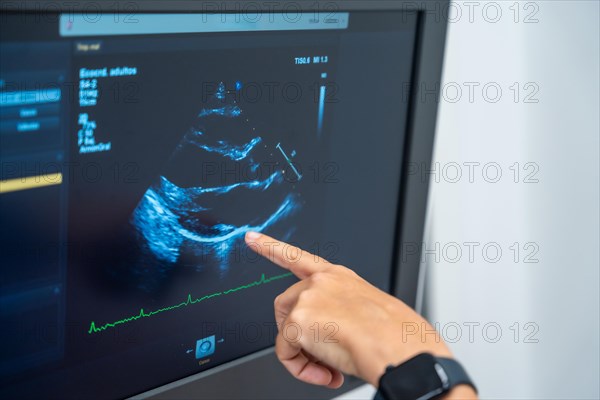 Cardiology clinic with a new ultrasound machine for echocardiogram exams to clients