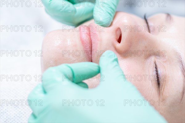 Portrait of a woman's face with problem skin. Peeling procedure. Natural beauty.