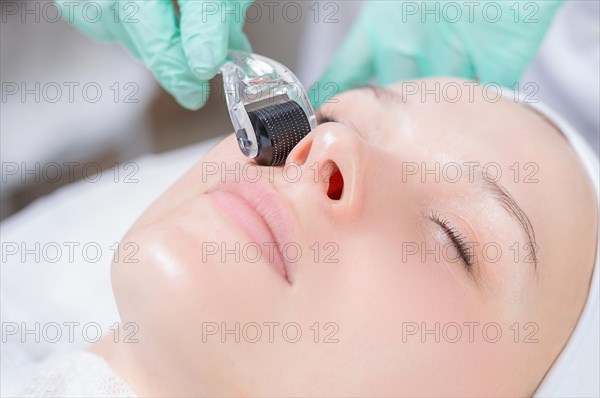 Portrait of a woman's face with problem skin. Peeling procedure. Natural beauty.