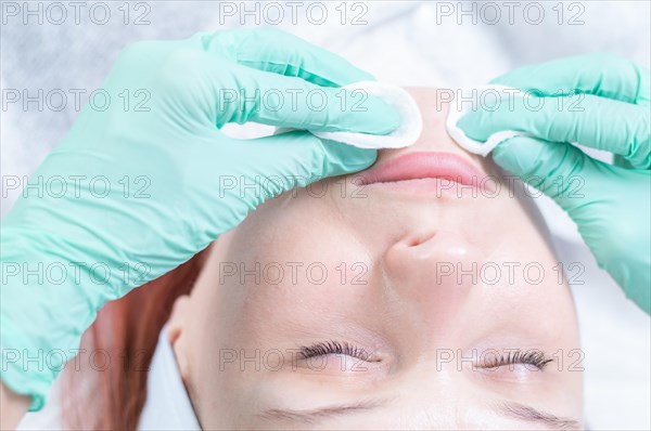 Portrait of a woman's face with problem skin. Peeling procedure. Natural beauty.