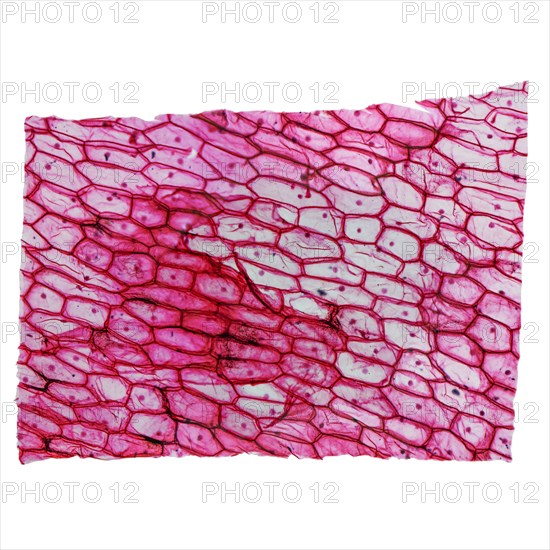 Onion epidermus micrograph