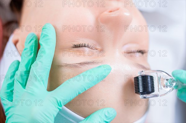 Portrait of a woman's face with problem skin. Peeling procedure. Natural beauty.