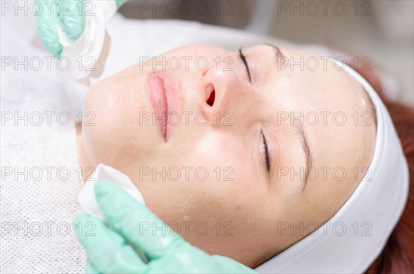 Portrait of a woman's face with problem skin. Peeling procedure. Natural beauty.