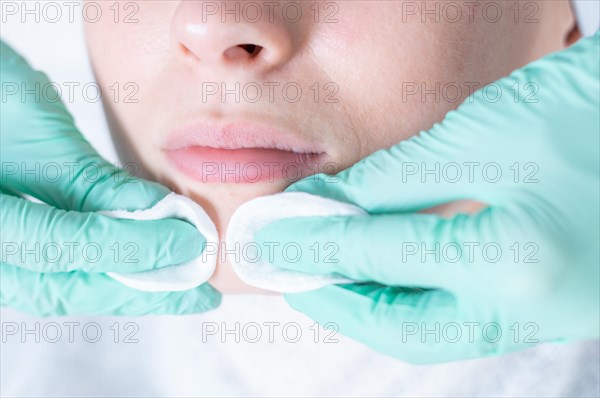 Portrait of a woman's face with problem skin. Peeling procedure. Natural beauty.